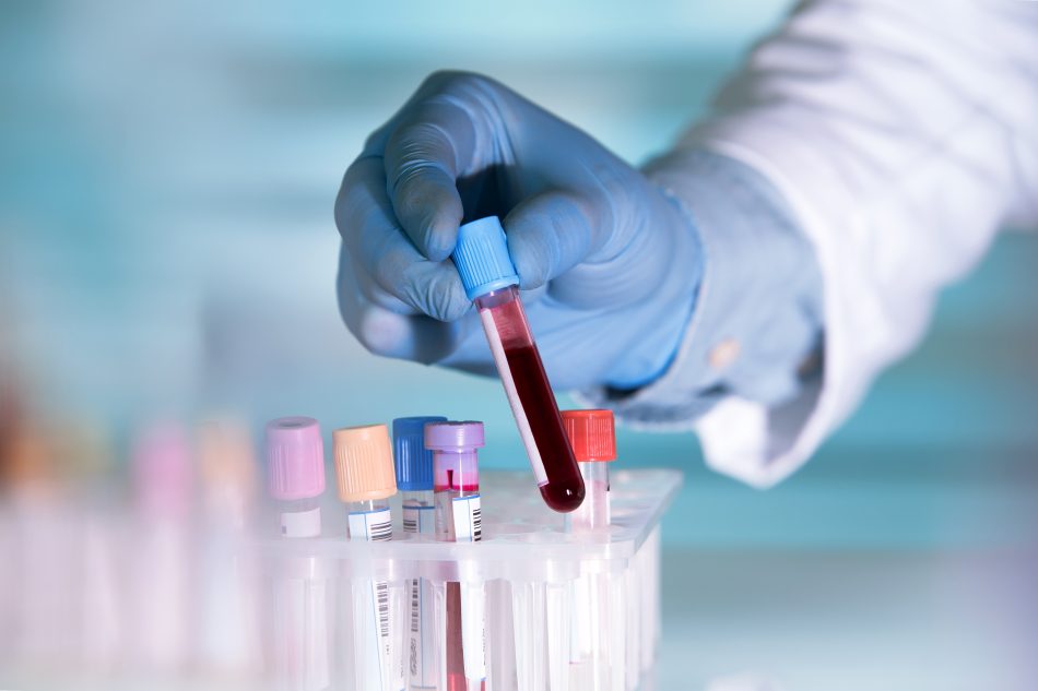 Breast cancer: An innovative blood test could help early discovery